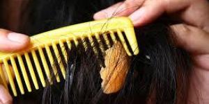 بهذه العلاجات المنزلية.. اكتشفي طريقة لإزالة العلكة من الشعر